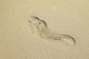Plantar Fasciitis